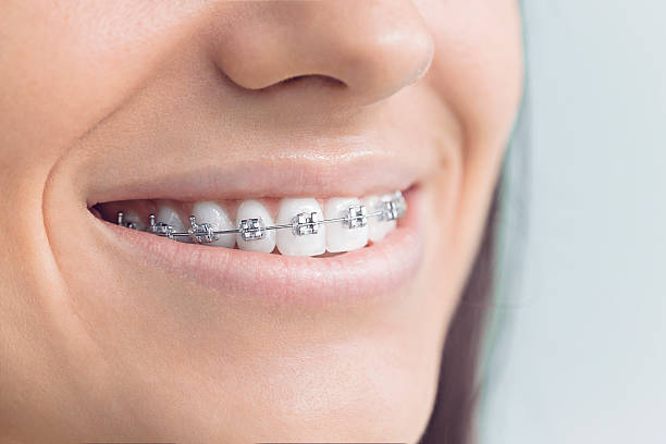 Why Choose Us for Your Dental Needs in Ashland, NE
